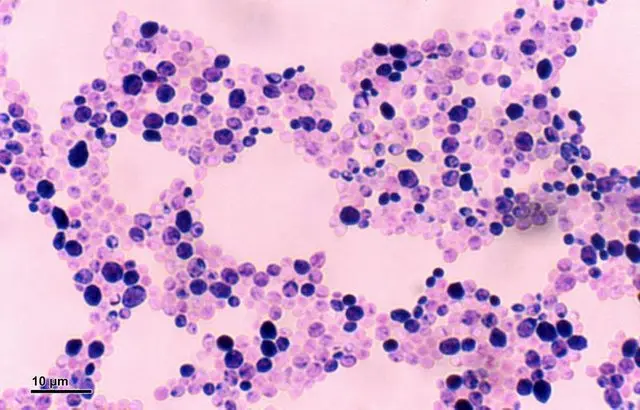 candida under microscope