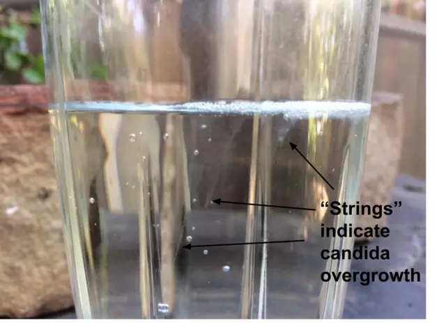 Candida Cleanse spit test