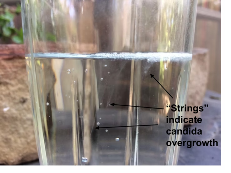 candida spit test results